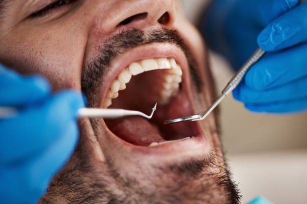 Best Broken or Cracked Tooth Emergency Dentist in Highland Falls, NY